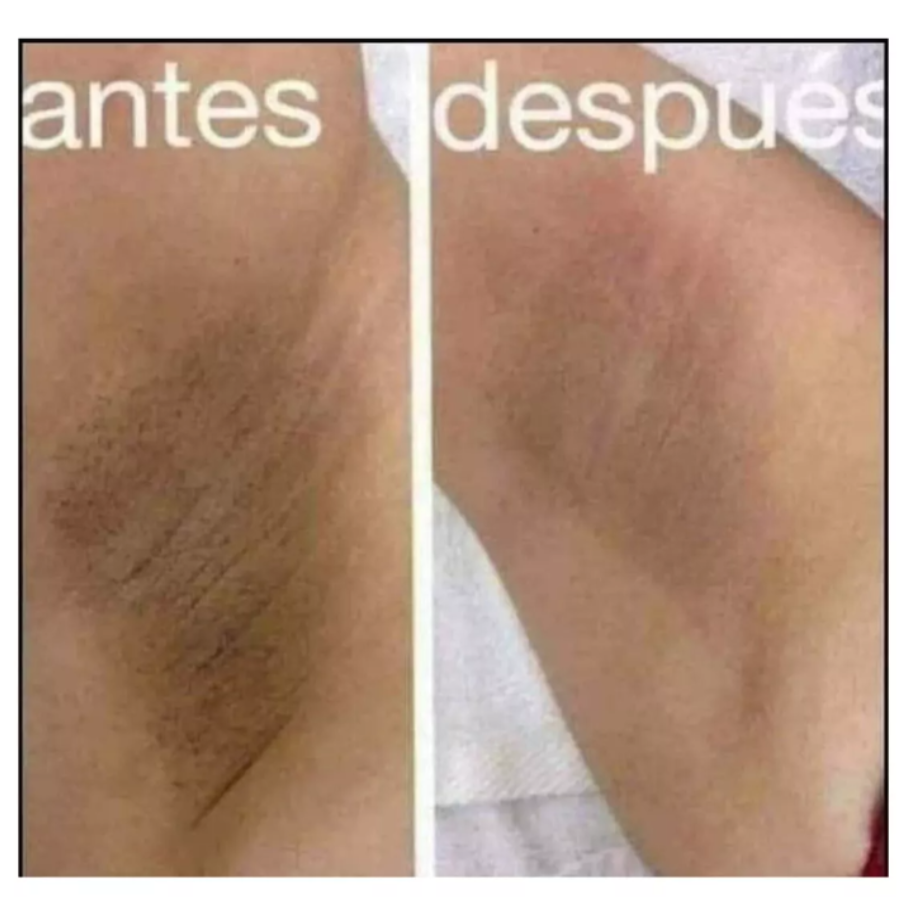 Crema Aclaradora Para Piel - No mas  manchas  En Cara , Cuerpo y Manos