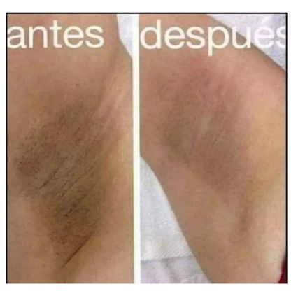 Crema Aclaradora Para Piel - No mas  manchas  En Cara , Cuerpo y Manos